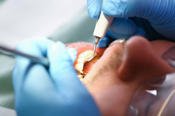 Best Root Canal Emergency Dentist  in New Roads, LA