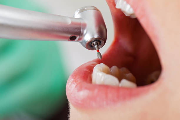 Best Broken Tooth Emergency  in New Roads, LA